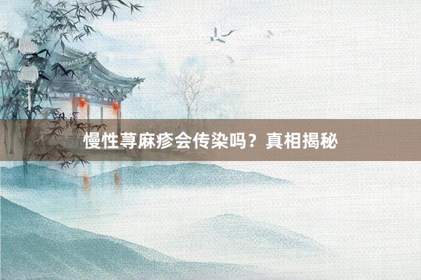 慢性荨麻疹会传染吗？真相揭秘